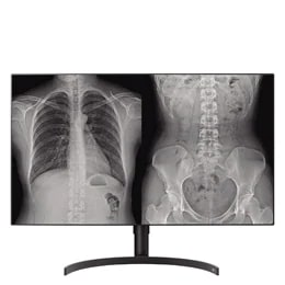 LG Medical Display Image